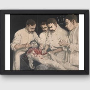 May include: A vintage medical illustration depicting a group of four surgeons performing surgery on a patient. The surgeons are wearing white coats and are using surgical instruments. The patient is lying on a table and has an open chest cavity. The illustration is in a realistic style and is rendered in shades of gray and brown.