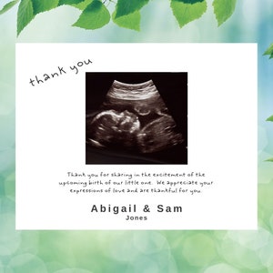 Tarjeta de agradecimiento para baby shower con foto de ultrasonido digital / Tarjeta de agradecimiento para baby shower / Tarjeta de agradecimiento para bebé / Tarjeta de agradecimiento para baby shower / Gracias