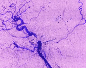 TWO Blood Pudding Press/Dusie Kollektiv Poetry Chapbooks by Juliet Cook - special price - Soft Foam and POST STROKE