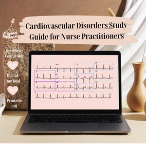 Op de afbeelding: Een laptopcomputer die een elektrocardiogram (ECG) weergeeft met de titel "Cardiovascular Disorders Study Guide for Nurse Practitioners". Het ECG toont verschillende afleidingen van het hartritme.