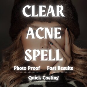Clear Acne Spell | Clear Sking Spell | Ideal Beauty Spell | Perfect Fasce Spell | Become Much More Beautiful | Fast Casting Spell