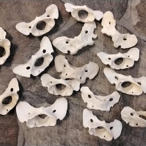 May include: A collection of small, off-white, bone-shaped objects with holes and curved edges. The objects are scattered on a textured, gray surface, creating a pattern. The shapes appear to be anatomical.