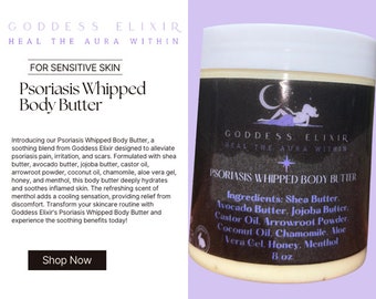 Psoriasis Body Butter