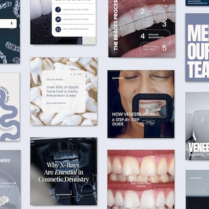 Social Media Templates für Zahnärzte: Kieferorthopäde Instagram Posts (Canva)