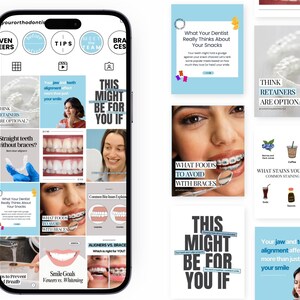Kieferorthopäde Instagram Vorlagen | Zahnspangen & Invisalign Social Media Kit | Modernes Design für Kieferorthopädie und Kieferorthopädie