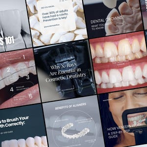 Modelli di social media per ortodontisti, post di Instagram, storie e reel per apparecchi ortodontici, allineatori, sbiancamento dei denti e trattamenti estetici