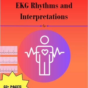 EKG Interpretation Study Guide for Nursing Students, Cheat Sheet, Rhythm & Arrythmias, ECG