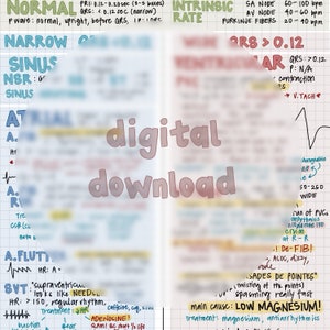EKG Cheat Sheet - Digital Download - Etsy