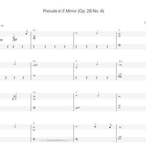 Puede incluir: Partitura para piano de una pieza titulada "Preludio en Mi menor (Op. 28 No. 4)" de Chopin. La música está escrita en notación estándar e incluye una indicación de tempo de =100.