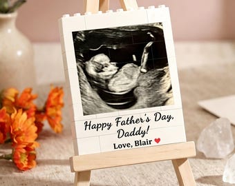 Personalised Ultrasound Building blocks,Baby Scan Photo Building Block,PuzzleDecor,Building blocks,Gifts for New Daddy,Chirstmas Gift