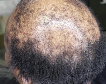 Aceite para el crecimiento del cabello TrustTheProcess, producto unisex, totalmente natural.