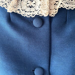 May include: Close-up of a navy blue garment with a cream-colored lace collar. The garment has two navy blue buttons. The fabric appears to be a smooth, woven material.