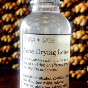 Acne Drying Lotion ..... Spot Treatment.....2 ounce glass bottle.  FREE SHIPPING