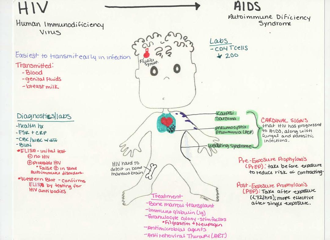 HIV & AIDS Nursing Bundle | Concept Maps + Doodle | Pathophysiology ...