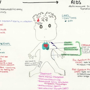 Könnte beinhalten: Eine handgezeichnete Grafik, die HIV und AIDS veranschaulicht, mit Textbeschriftungen, die Übertragung, Diagnostik und Behandlungen detailliert beschreiben. Das Bild zeigt eine Strichmännchenfigur mit beschrifteten Körperteilen und medizinischen Begriffen.