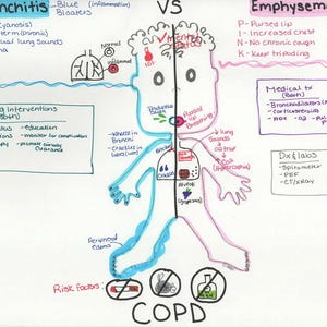 Può includere: Un'illustrazione medica che confronta bronchite ed enfisema, con etichette di testo e diagrammi. L'immagine è divisa verticalmente, con bronchite a sinistra ed enfisema a destra. Sono indicati anche i fattori di rischio per la BPCO.