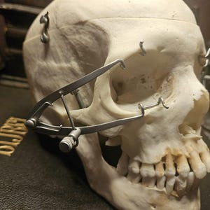 Könnte beinhalten: Nahaufnahme eines menschlichen Schädels mit einem silberfarbenen chirurgischen Instrument. Der Schädel ist cremefarben, mit sichtbaren Zähnen und Augenhöhlen. Das Instrument hat eine Schraube und verstellbare Arme.