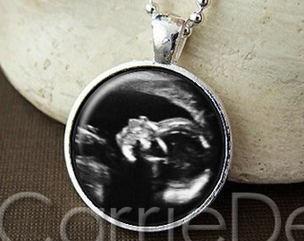 Custom Sonogram Pendant, Ultrasound Necklace, Baby Memorial Jewelry, Mother To Be, Father To Be, Baby Shower Gift