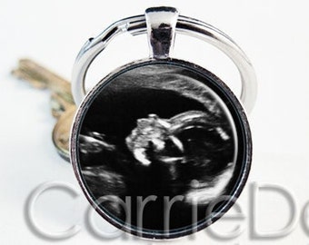Custom Sonogram Keyring, Ultrasound Key Chain, Baby Memorial Gift, Mother To Be, Father To Be, Baby Shower Gift