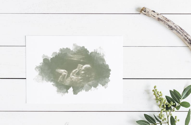 Baby Ultrasound Art, Watercolor Sonogram Print, Baby Shower Gift, Gender Reveal, Sonography Art, Pregnancy Gift, Ultrasound Art for Wall image 7