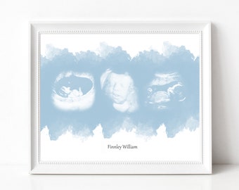 Baby Ultrasound Art, Watercolor Sonogram Print, Baby Shower Gift, Gender Reveal, Sonography Art, Pregnancy Gift, Ultrasound Art for Wall