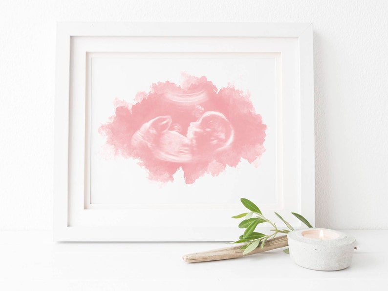 Baby Ultrasound Art, Watercolor Sonogram Print, Baby Shower Gift, Gender Reveal, Sonography Art, Pregnancy Gift, Ultrasound Art for Wall image 5