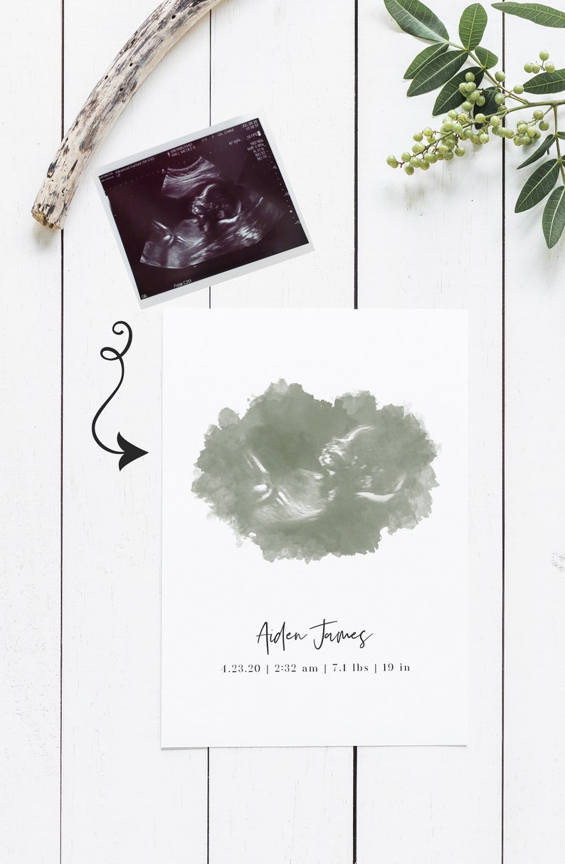 Watercolor Ultrasound Art Print, Baby Shower Gifts, Gender Reveal, Name Reveal, Sonogram Gifts, Custom Nursery Decor, Pregnancy Gift image 3