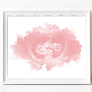 May include: A pink watercolor background with a black and white ultrasound image of a baby in the center.