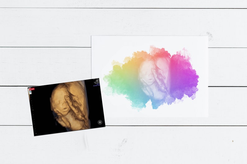 K&ouml;nnte beinhalten: Ein 3D-Ultraschallbild eines Babys im Mutterleib mit einem bunten Aquarellhintergrund.