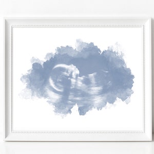 Ultrasound Art Print, Watercolor Sonogram, Mom to Be, Dad to Be, Gender Reveal, Sonogram Gifts, Custom Nursery Decor, Pregnancy Gift