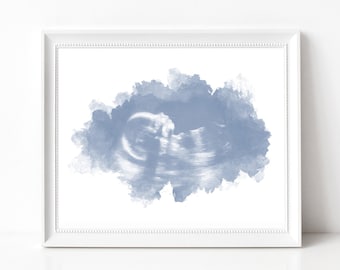 Watercolor Ultrasound Art Print, Baby Shower Gifts, Gender Reveal, Name Reveal, Sonogram Gifts, Custom Nursery Decor, Pregnancy Gift