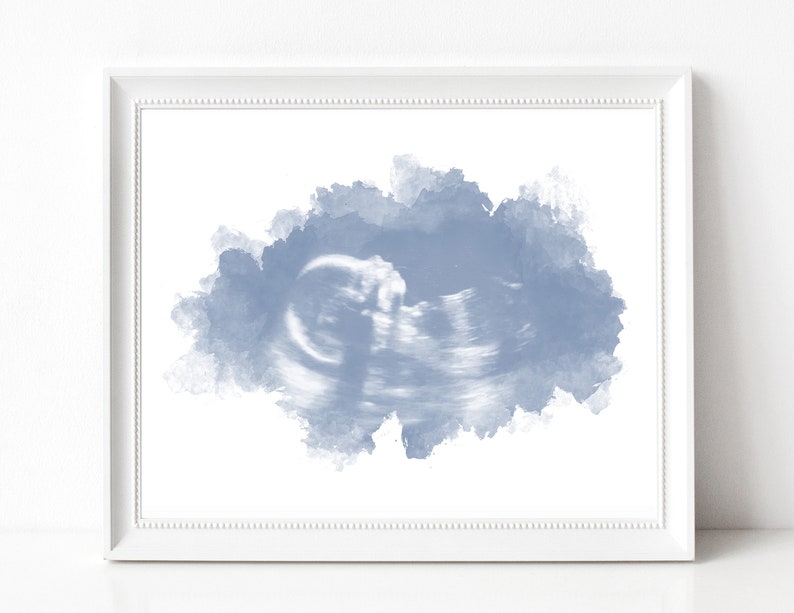 Watercolor Ultrasound Art Print, Baby Shower Gifts, Gender Reveal, Name Reveal, Sonogram Gifts, Custom Nursery Decor, Pregnancy Gift image 1