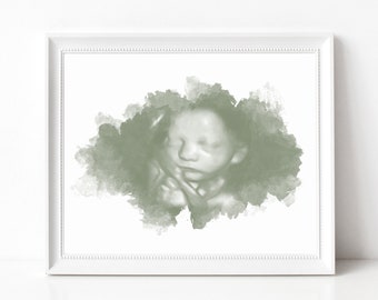 Op de afbeelding: Een aquarelachtige afbeelding van een 3D-echo van een baby in een groen-wit kleurenschema.