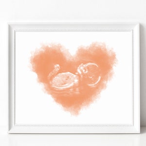 Baby Ultrasound Art, Watercolor Sonogram Print, Baby Shower Gift, Gender Reveal, Sonography Art, Pregnancy Gift, Ultrasound Art for Wall