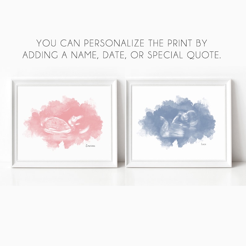 Watercolor Ultrasound Art Print, Baby Shower Gift, Gender Reveal, Name Reveal, Sonogram Gifts, Push Present for Wife, Pregnancy Gift New Mom image 4