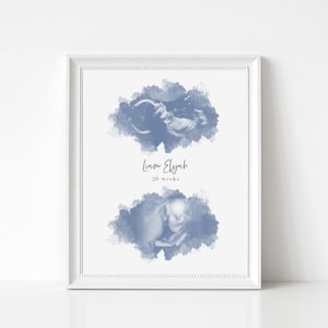 May include: A white framed print with two blue watercolor clouds. The clouds contain ultrasound images of a baby at 20 weeks. The text "Liam Elijah 20 weeks" is printed below the top cloud.