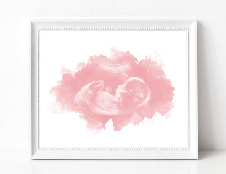 Baby Ultrasound Art, Watercolor Sonogram Print, Baby Shower Gift, Gender Reveal, Sonography Art, Pregnancy Gift, Ultrasound Art for Wall image 1