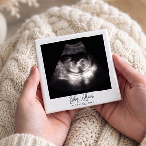 Personalisierte Keramikfliese mit Baby-Scan-Foto als Geschenk, individuelle Erinnerung an die Schwangerschaftsverkündung per Ultraschall