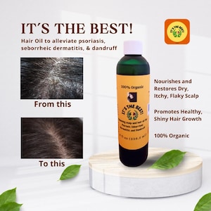 100% Organic Hair Oil to alleviate psoriasis, seborrheic dermatitis, & dandruff.
