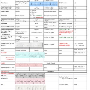 ECG Dysrhythmia Rules Cheat Sheet & Study Guide