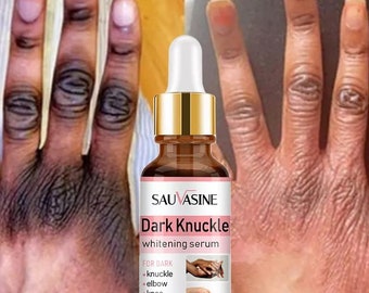 Dark Knuckle Whitening Serum – Gleichmäßiger Ton, 50 ml – Schnelle Ergebnisse