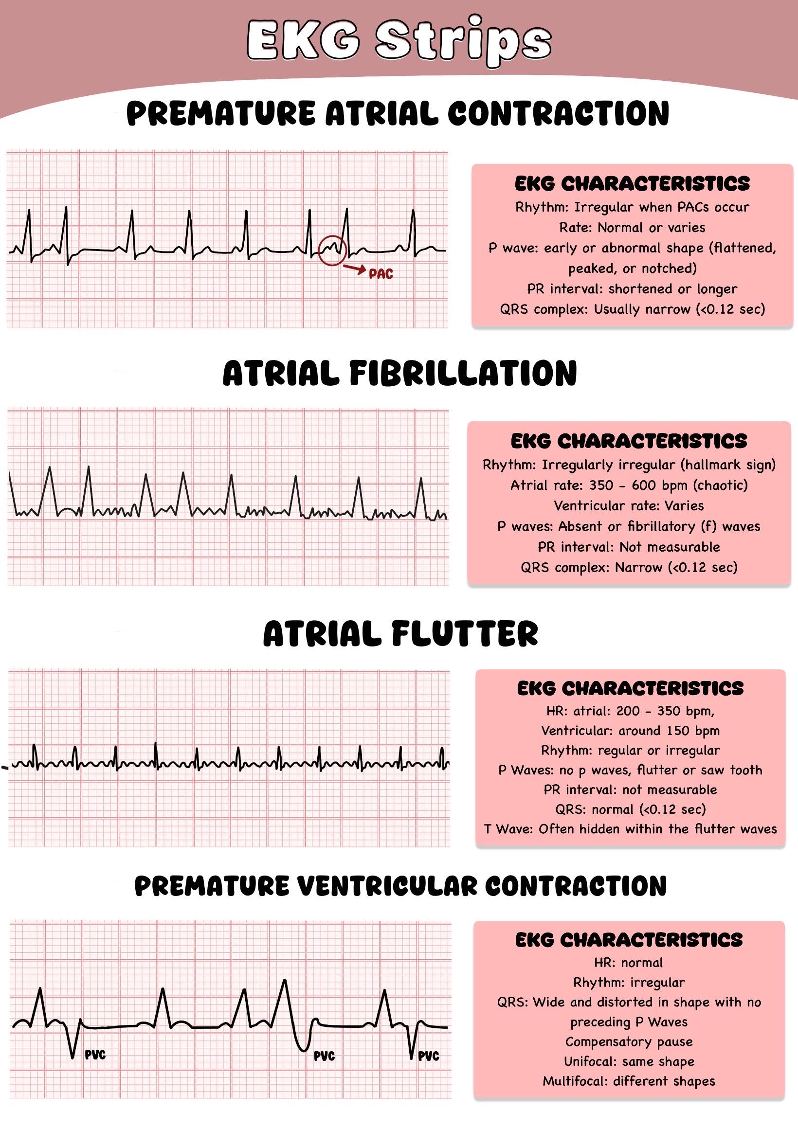 EKG Made Easy - Etsy