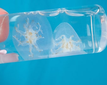 May include: Two translucent jellyfish with brown markings are preserved in a clear glass tube. The tube is held by a hand against a bright blue background.