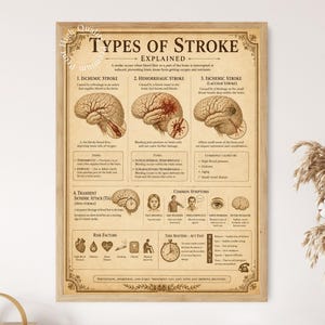 May include: A framed educational poster titled Types of Stroke Explained, featuring a vintage-style beige background with black text and anatomical illustrations of the human brain. It details ischemic, hemorrhagic, and lacunar strokes, symptoms, and risk factors.