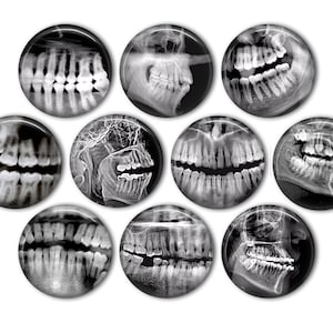 Dental X-ray Pin Back Buttons, Backpack Pins, Jacket Buttons, Flat Back Buttons, Party Favors, Halloween Decor, Teeth, Dental Gift, X-rays