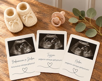 May include: Three white announcement cards featuring black and white ultrasound images, each with text and a heart line drawing. Accompanied by a pair of cream-coloured knit baby booties with bows and a pale pink dummy.