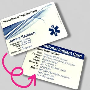 Może przedstawiać: Dwie białe karty International Implant Card z niebieskimi akcentami. Jedna karta wyświetla informacje o pacjencie, w tym imię i nazwisko, numer szpitala i datę wszczepienia. Druga karta zawiera szczegóły dotyczące implantu chirurgicznego.