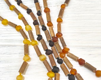 amber necklace for eczema