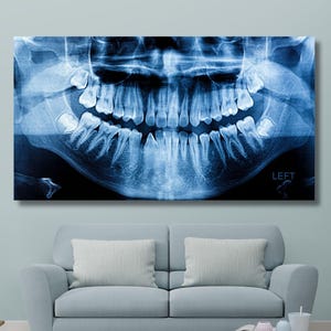 Arte de pared con rayos X panorámicos de dientes dentales, lienzo para consultorio dental, decoración de pared grande, arte de pared con rayos X panorámicos médicos, lienzo listo para colgar