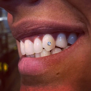 Grillz, Grills, Teeth Grill,  tooth bling, dental grill, teeth grillz, teeth diamonds